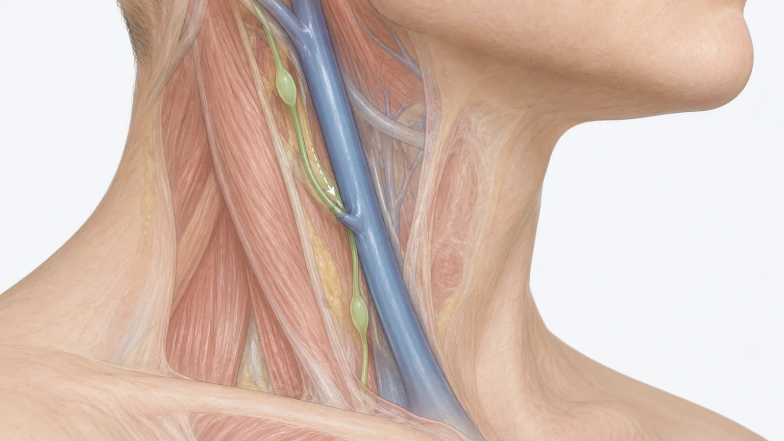 A proposed neck operation puts Alzheimer’s drainage theory to a human test