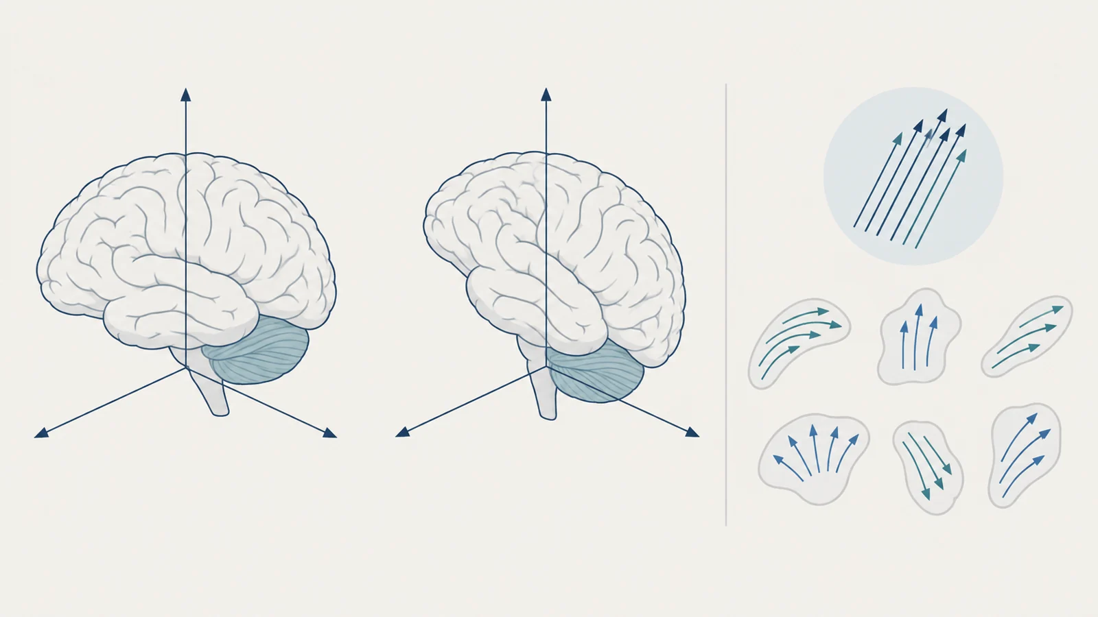 Three ways to calculate a brain MRI score—and what each changes